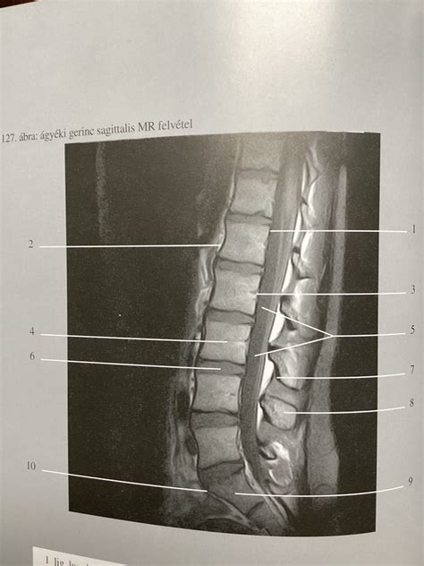 A gerinc fontossága a pilatesben