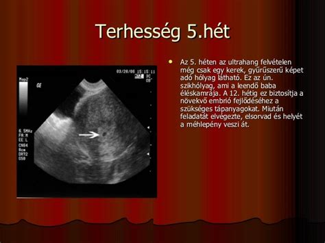 Petezsák ultrahangképen, üres és embrióval