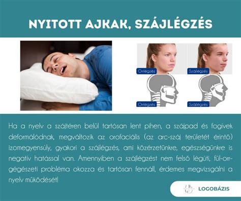 Gyermek arcának fejlődése szájlégzés esetén