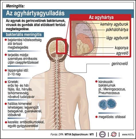 Gyermekorrmandula-megnagyobbodás tünetei