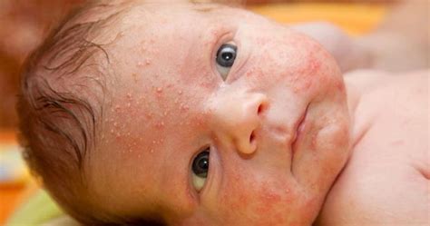 Baba arcán tejkiütés