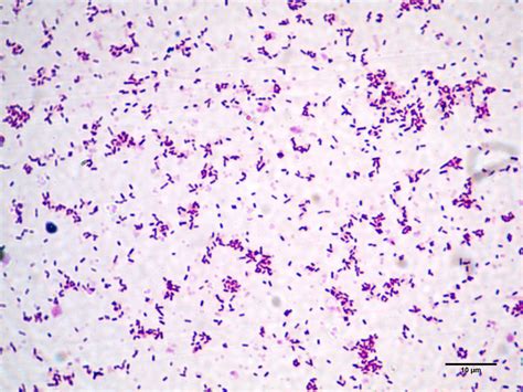 Listeria monocytogenes a jégkrémben