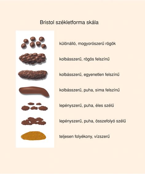 A normális és a rendellenes széklet típusait bemutató infografika