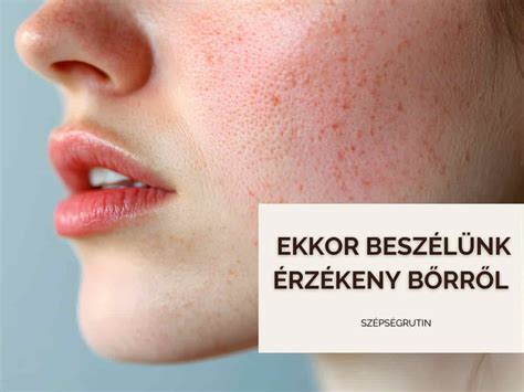 Érzékeny bőr ápolása