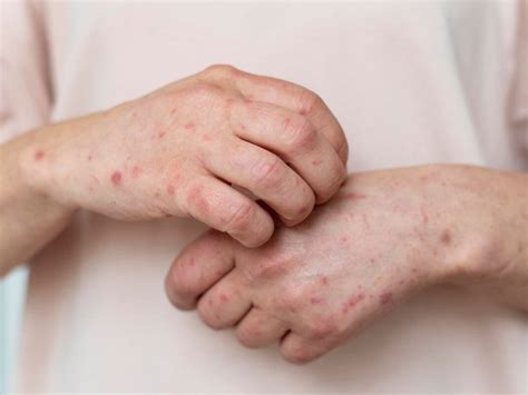 A humán papillomavírus (HPV) mikroszkopikus képe