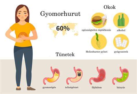 A gyomorhurut leggyakoribb tünetei