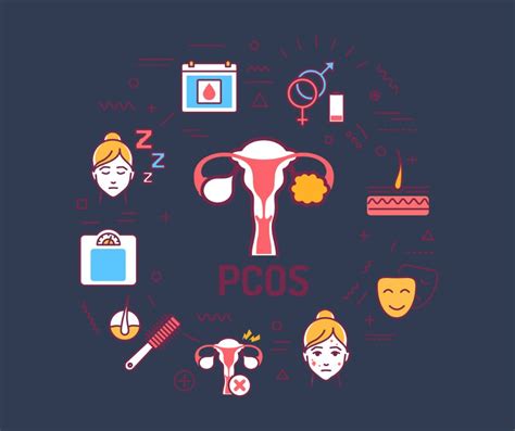 PCOS-ben szenvedő nőket ábrázoló infografika