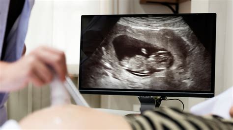 Az első trimeszteri ultrahang vizsgálat