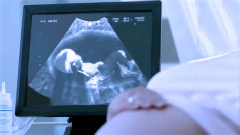 A terhesgondozás során végzett vizsgálatok a praeeclampsia szűrésére