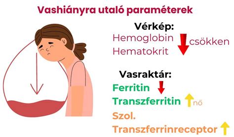 Vashiány diagnosztizálása