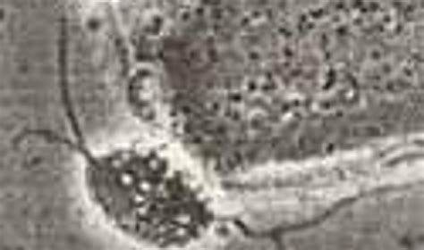 Mikroszkópos kép <i>Trichomonas vaginalis</i> fertőzésről