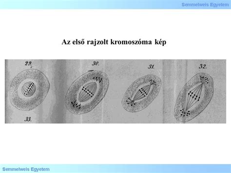 Kromoszóma-eltérések típusai