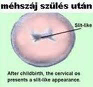 A méhszáj tágulásának folyamata a szülés során