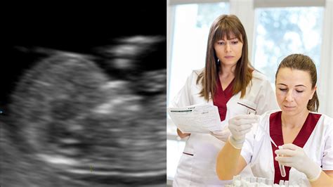 Ultrahangvizsgálat a női kismedencén