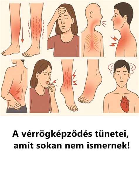 Vérrögképződés folyamatát illusztráló grafika