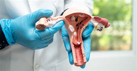 Táblázat a petefészek ciszták típusairól és jellemzőiről