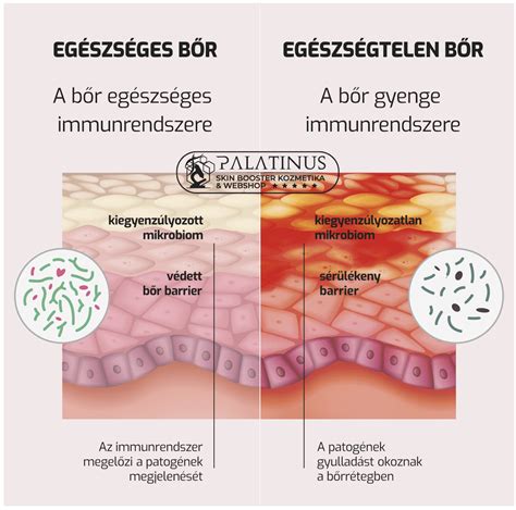 A hüvelyi mikrobiom egyensúlya és diszbiózis