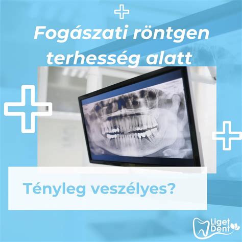 A fogászati kezelések ütemezése a terhesség alatt