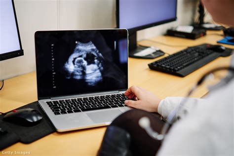 Ultrahangvizsgálat a vetélés diagnosztizálására