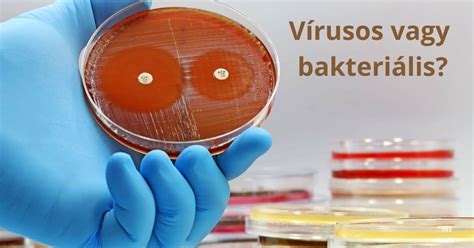 Vizuális ábrázolás a bakteriális fertőzések és a koraszülés közötti kapcsolaton