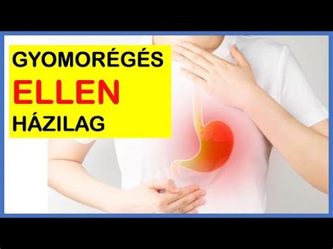 Összefoglaló a gyomorégés enyhítésére szolgáló házi praktikákról