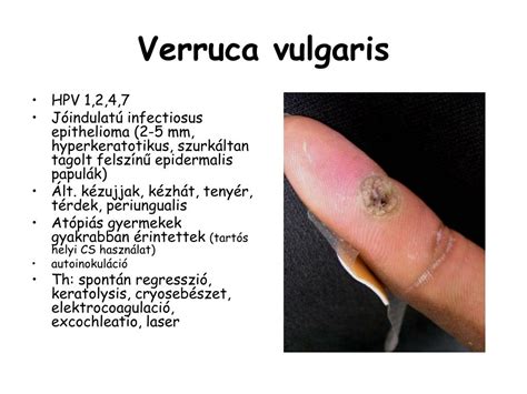 Bőrgyógyászati kórképek, melyekre a Mofuder krém alkalmazható