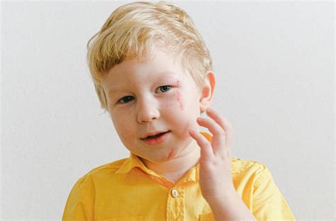 Az ótvar kezelésének lépései