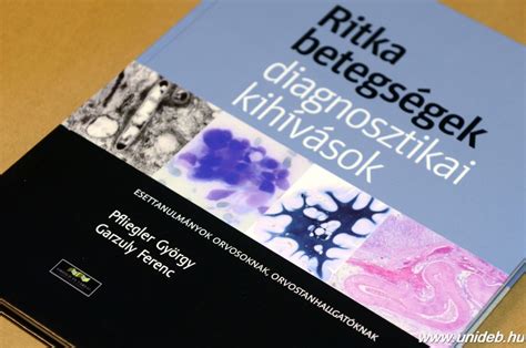 A ritka betegségek definíciója és gyakorisága