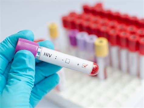 HIV vírus és immunrendszer kölcsönhatása