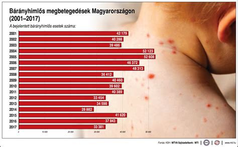 Bárányhimlő elleni oltóanyagok