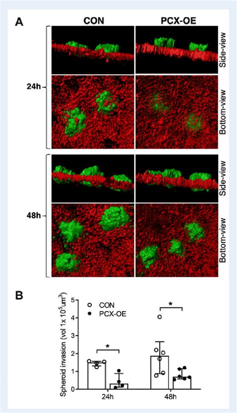 A podocalyxin (PCX) molekula hatását ábrázoló tudományos illusztráció