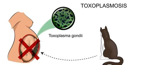 A toxoplazmózis terjedési útvonalai