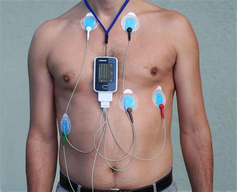 Holter monitor készülék