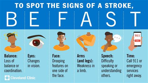 A stroke FAST tünetei