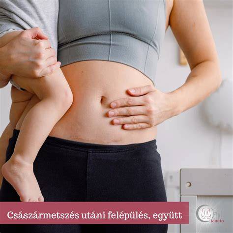 császármetszés utáni sebápolás