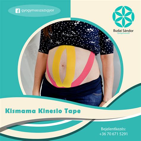 Kismama hasán kinesio tape ragasztás