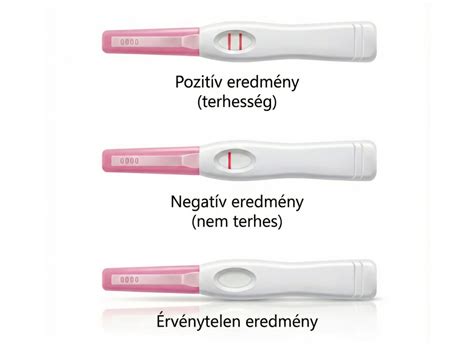 Terhességi lábdagadás illusztráció