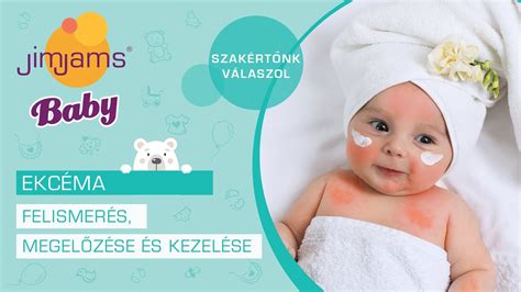 A csecsemőkori ekcéma elterjedése