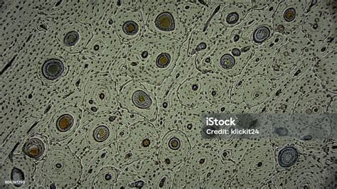 Vörösvérsejtek mikroszkóp alatt