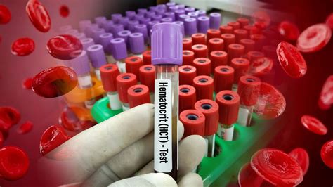 Hematokrit mérése laboratóriumban