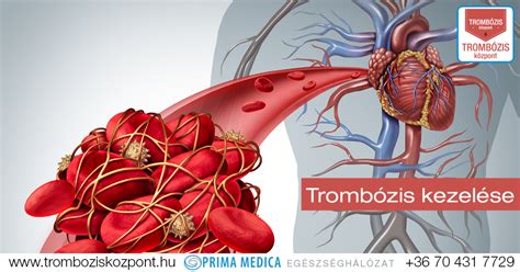 Trombózis szűrése és kezelése a terhesség alatt