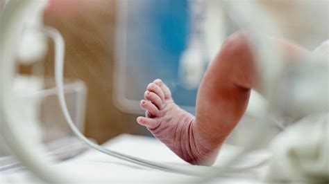újszülöttkori sarokszúrásos szűrővizsgálat folyamata