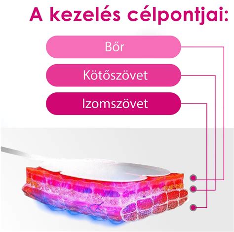 Pulzáló festéklézeres kezelés elve