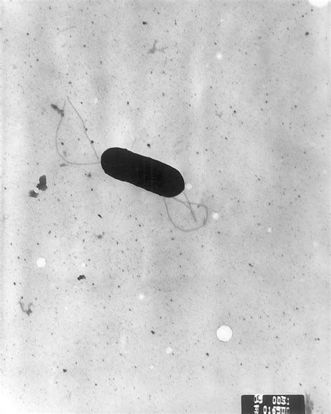 Listeria baktérium mikroszkóppal