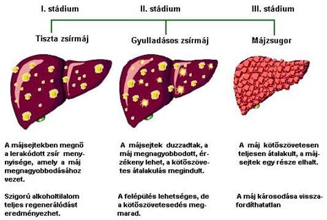 Májbetegség és tünetei