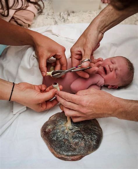 A méhlepény ábrája