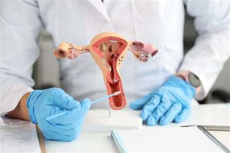 Méhszáj állapotát jelző cervix index
