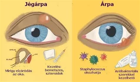 Szemárpa
