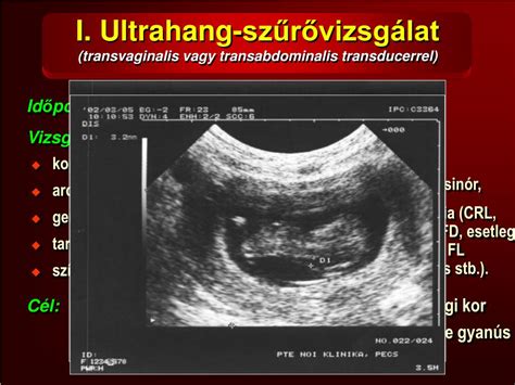 Petezsák és szikhólyag az ultrahangon