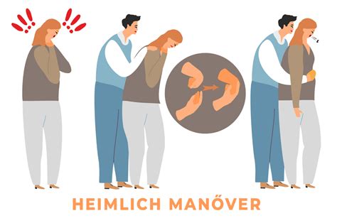 Illusztráció a Heimlich-fogás helyes kivitelezéséről nagyobb gyermeknél